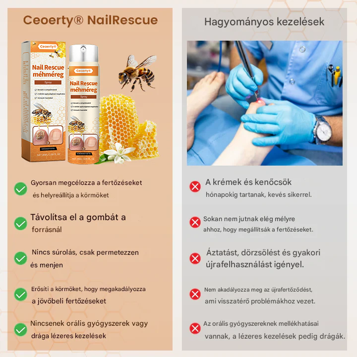 💥 2026 Korlátozott 70% KEDVEZMÉNY ️⏳ Ceoerty® NailRescue Kolirin méhméreg körömgomba spray 💥 Minden körömproblémát orvosolhatsz 2 héten belül🐝