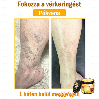 🔥🐝 VLSVLS® Méhméreg Bőrhelyreállító Krém | Teljeskörű Bőrregenerálás | Ekcéma, Pikkelysömör, Rosacea, Szemölcsök & Hegek Ellen | Gyors Hatás 5 Nap Alatt | 100% Természetes & Nem Invazív Megoldás 💯✨