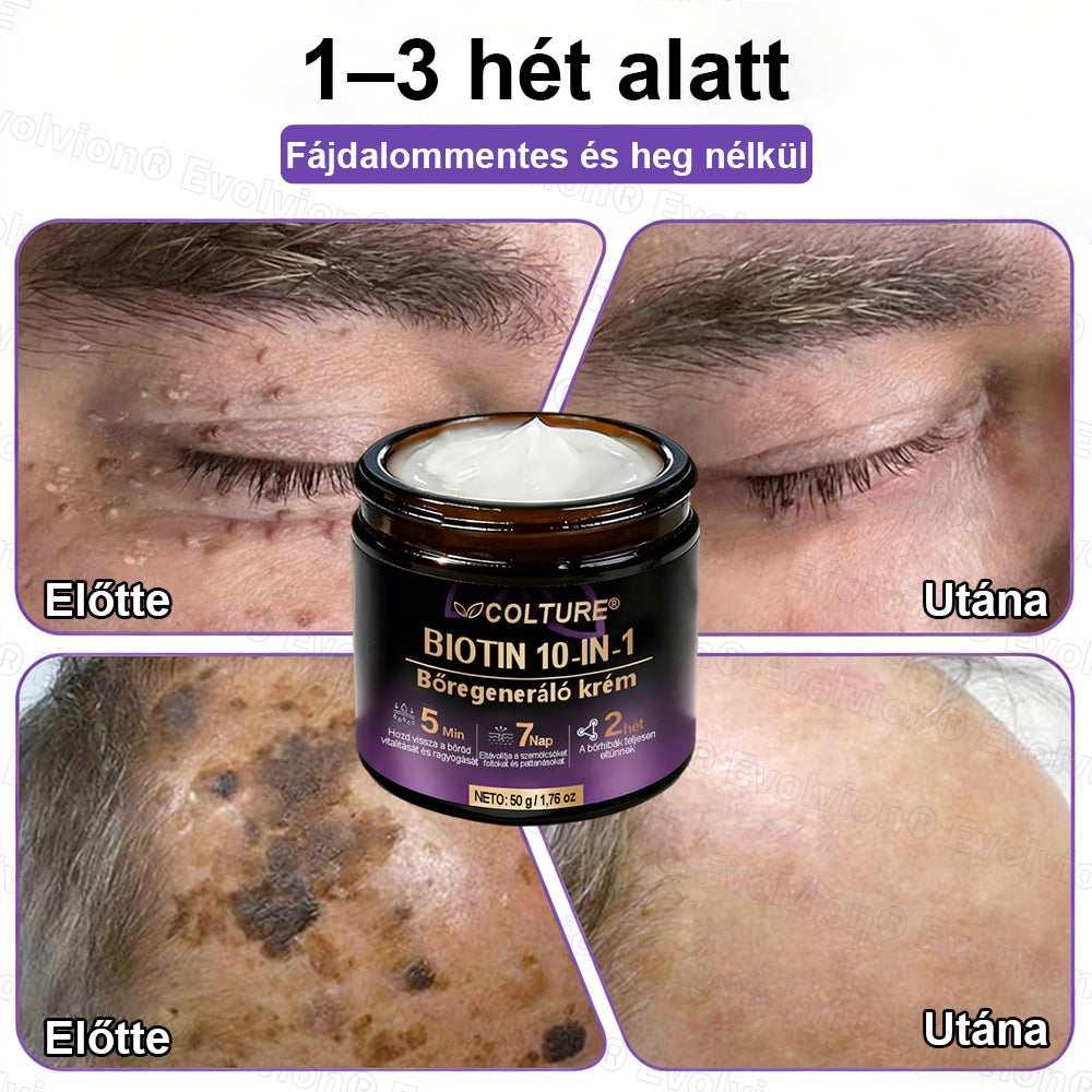 COLTURE® Biotin 10 az 1-ben bőrmegújító krém ✨ öregedés, pikkelysömör, akné, hegek, pigmentfoltok, szárazság, gyulladás és intim kellemetlenségek ellen 🌿 természetes bioaktív összetevőkkel 💧 a sima, feszes és fiatalos bőrért