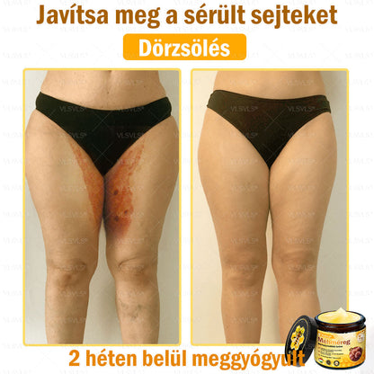 🔥🐝 VLSVLS® Méhméreg Bőrhelyreállító Krém | Teljeskörű Bőrregenerálás | Ekcéma, Pikkelysömör, Rosacea, Szemölcsök & Hegek Ellen | Gyors Hatás 5 Nap Alatt | 100% Természetes & Nem Invazív Megoldás 💯✨
