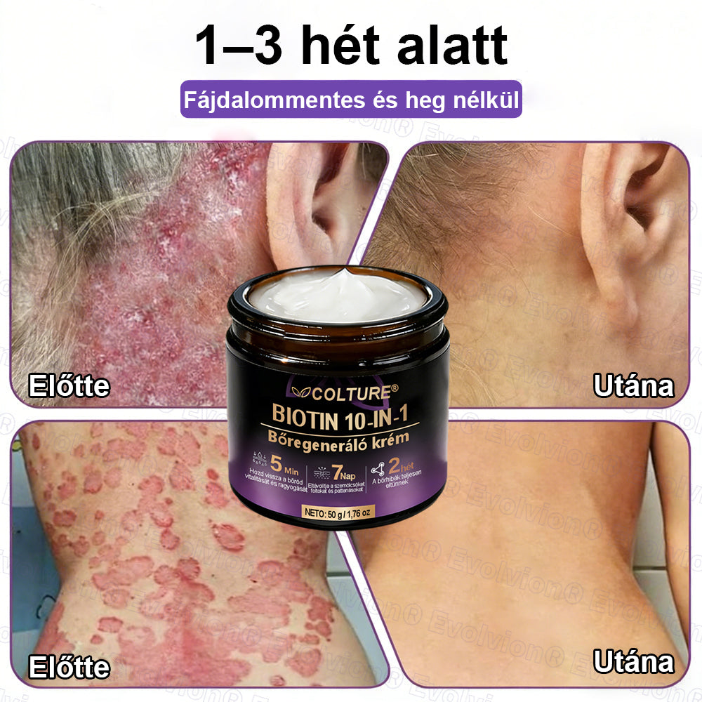 COLTURE® Biotin 10 az 1-ben bőrmegújító krém ✨ öregedés, pikkelysömör, akné, hegek, pigmentfoltok, szárazság, gyulladás és intim kellemetlenségek ellen 🌿 természetes bioaktív összetevőkkel 💧 a sima, feszes és fiatalos bőrért