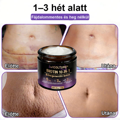 COLTURE® Biotin 10 az 1-ben bőrmegújító krém ✨ öregedés, pikkelysömör, akné, hegek, pigmentfoltok, szárazság, gyulladás és intim kellemetlenségek ellen 🌿 természetes bioaktív összetevőkkel 💧 a sima, feszes és fiatalos bőrért