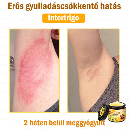 🔥🐝 VLSVLS® Méhméreg Bőrhelyreállító Krém | Teljeskörű Bőrregenerálás | Ekcéma, Pikkelysömör, Rosacea, Szemölcsök & Hegek Ellen | Gyors Hatás 5 Nap Alatt | 100% Természetes & Nem Invazív Megoldás 💯✨