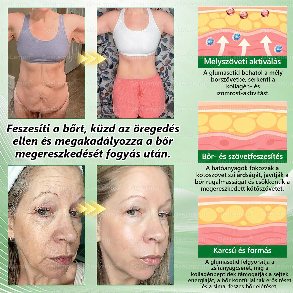 𝐆𝐞𝑒𝐿𝑒𝐦𝐨𝐧® Glumasetide 8 az 1-ben Karcsú és Egészséges Nano Mikrotűs Tapasz (👩🏻‍⚕️ KÜLÖNLEGES KIÁRUSÍTÁS – UTOLSÓ NAP | 80 % KEDVEZMÉNY 🔥)