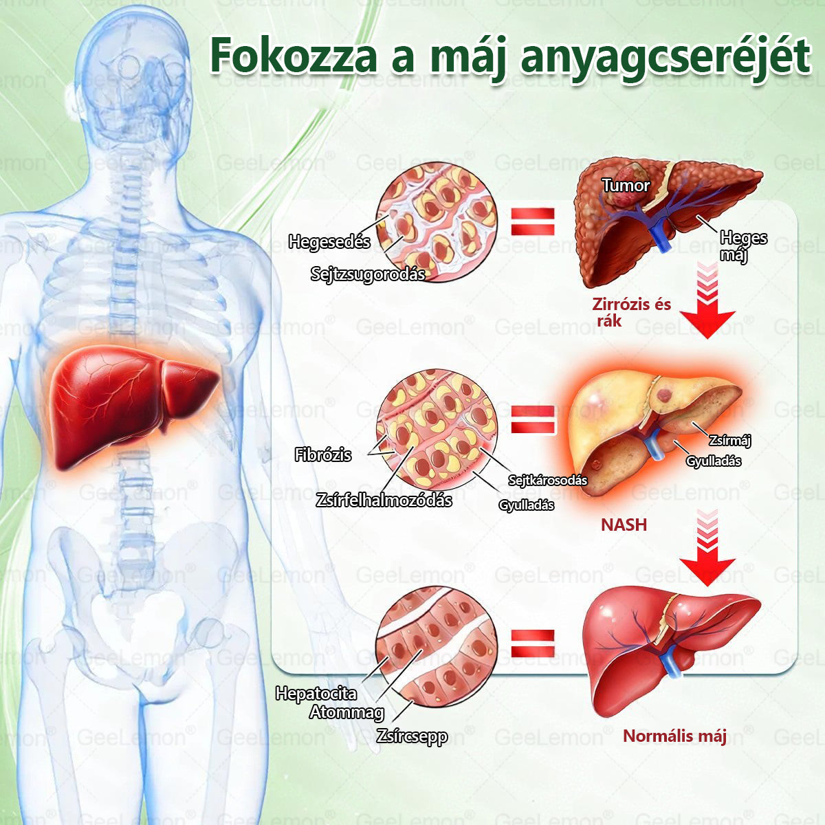 𝐆𝐞𝑒𝐿𝑒𝐦𝐨𝐧® Glumasetide 8 az 1-ben Karcsú és Egészséges Nano Mikrotűs Tapasz (👩🏻‍⚕️ KÜLÖNLEGES KIÁRUSÍTÁS – UTOLSÓ NAP | 80 % KEDVEZMÉNY 🔥)