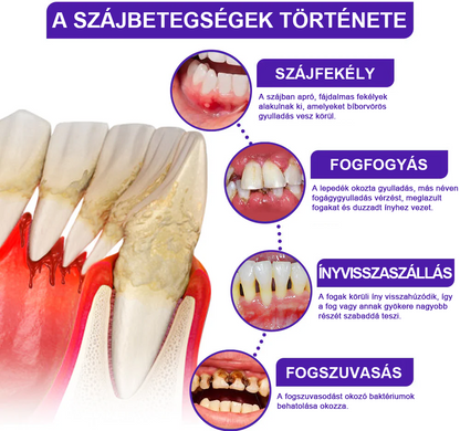 🌟 Rolimey® VioCore Propolisz fogkrém 🦷 Fogfájás enyhítése 3 nap alatt · 7 napos ínyregeneráció · Parodontális betegségek megelőzése · Méhméreg és természetes ásványi anyagok tökéletes kombinációja 🌟