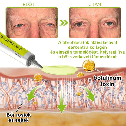 ✨ Vosxu™ Botox & Vita-A Retinol Shot ráncfelvarró szérum ✨ – 💉 Mikro-tűk | 💪 Botox-szerű peptidek | 🌿 Retinol | ⚡ Látható eredmények már 3 nap alatt