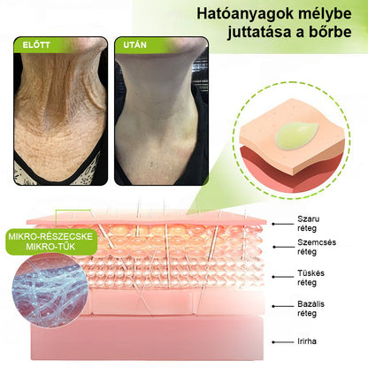 ✨ Vosxu™ Botox & Vita-A Retinol Shot ráncfelvarró szérum ✨ – 💉 Mikro-tűk | 💪 Botox-szerű peptidek | 🌿 Retinol | ⚡ Látható eredmények már 3 nap alatt