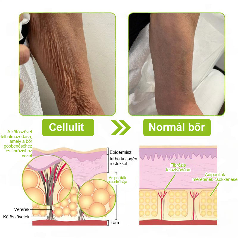 ✨ Vosxu™ Botox & Vita-A Retinol Shot ráncfelvarró szérum ✨ – 💉 Mikro-tűk | 💪 Botox-szerű peptidek | 🌿 Retinol | ⚡ Látható eredmények már 3 nap alatt