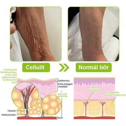 ✨ Vosxu™ Botox & Vita-A Retinol Shot ráncfelvarró szérum ✨ – 💉 Mikro-tűk | 💪 Botox-szerű peptidek | 🌿 Retinol | ⚡ Látható eredmények már 3 nap alatt