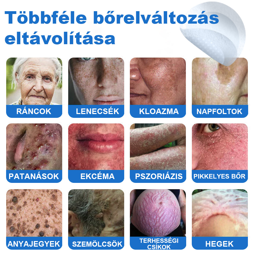 VeruDerm® 2 az 1-ben mikrotűs és hidrokolloid tapasz | Kiemelkedő anyajegyek, pattanások, lapos szemölcsök és bőrkinövések ápolására ✅ | Segít javítani a ráncok, hegek és bőrhibák megjelenését ✨ | Láthatatlan pattanástapasz arcra és testre | 144 db 🍃