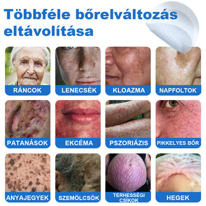 VeruDerm® 2 az 1-ben mikrotűs és hidrokolloid tapasz | Kiemelkedő anyajegyek, pattanások, lapos szemölcsök és bőrkinövések ápolására ✅ | Segít javítani a ráncok, hegek és bőrhibák megjelenését ✨ | Láthatatlan pattanástapasz arcra és testre | 144 db 🍃