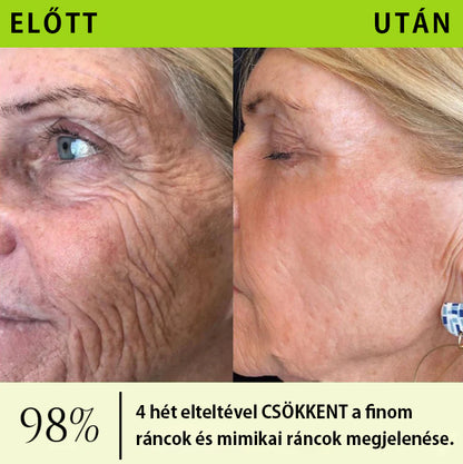 ✨ Vosxu™ Botox & Vita-A Retinol Shot ráncfelvarró szérum ✨ – 💉 Mikro-tűk | 💪 Botox-szerű peptidek | 🌿 Retinol | ⚡ Látható eredmények már 3 nap alatt