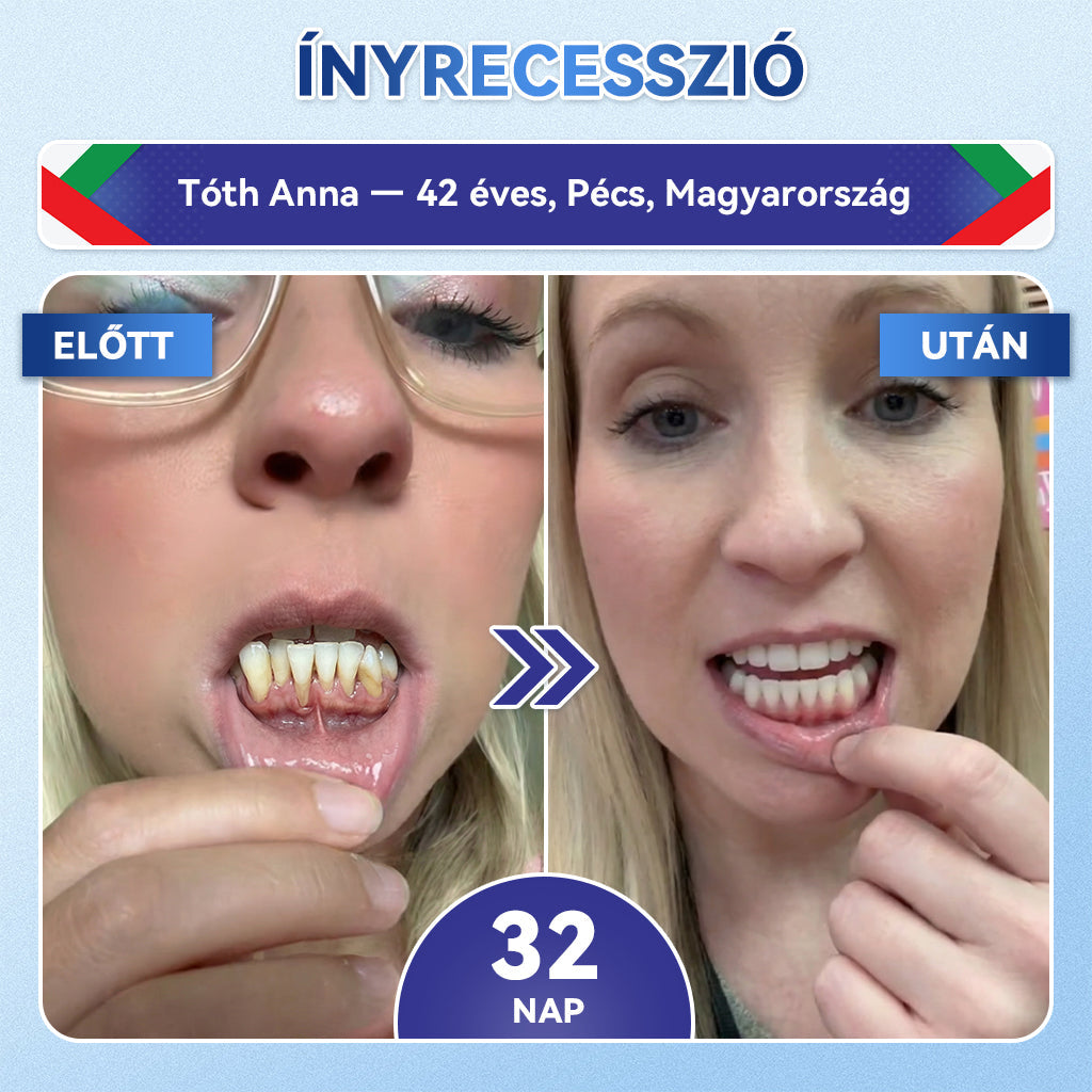 𝐆𝐥𝐢𝐦𝐦𝐞𝐫𝐥𝐲® Tideglusib orális csíkok – őssejtek aktiválása 🧬, dentin regeneráció 💎, zománcerősítés ⚡, fogfehérítés ✨, érzékenység csökkentése 💧, mikro-tűs szérum fogakhoz és ínyhez 💖, gyengéd mindennapi használatra 🦷