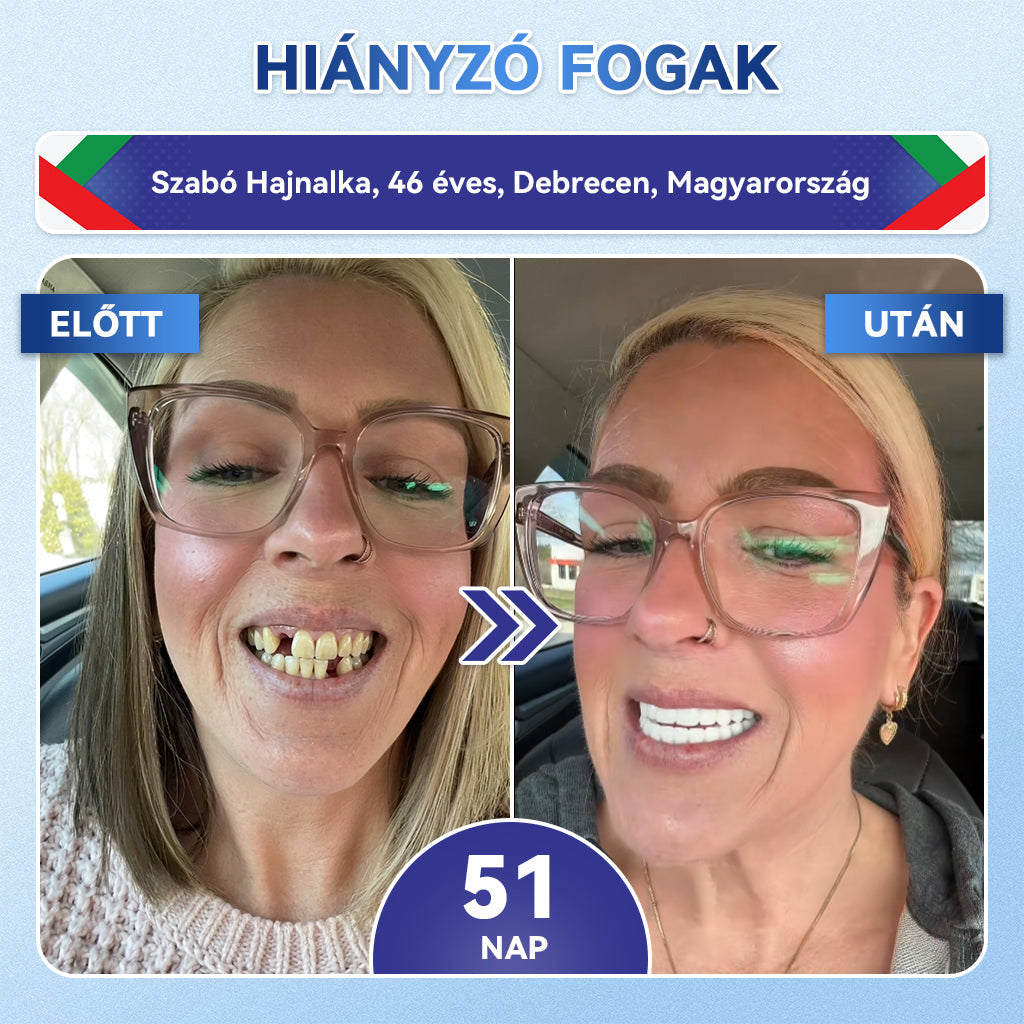𝐆𝐥𝐢𝐦𝐦𝐞𝐫𝐥𝐲® Tideglusib orális csíkok – őssejtek aktiválása 🧬, dentin regeneráció 💎, zománcerősítés ⚡, fogfehérítés ✨, érzékenység csökkentése 💧, mikro-tűs szérum fogakhoz és ínyhez 💖, gyengéd mindennapi használatra 🦷