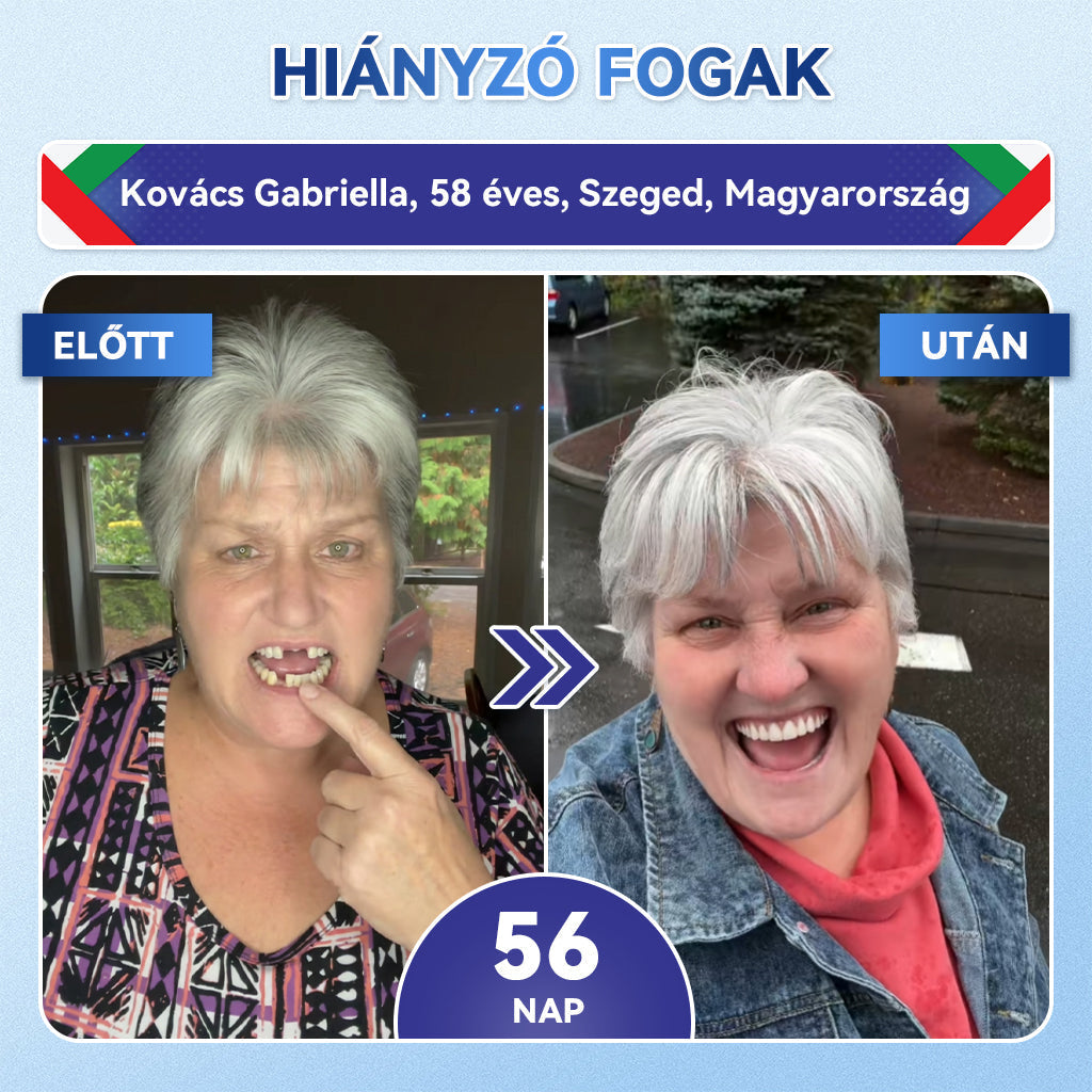 𝐆𝐥𝐢𝐦𝐦𝐞𝐫𝐥𝐲® Tideglusib orális csíkok – őssejtek aktiválása 🧬, dentin regeneráció 💎, zománcerősítés ⚡, fogfehérítés ✨, érzékenység csökkentése 💧, mikro-tűs szérum fogakhoz és ínyhez 💖, gyengéd mindennapi használatra 🦷