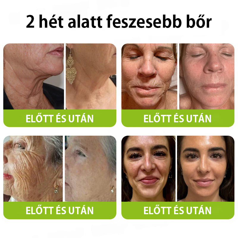 ✨ Vosxu™ Botox & Vita-A Retinol Shot ráncfelvarró szérum ✨ – 💉 Mikro-tűk | 💪 Botox-szerű peptidek | 🌿 Retinol | ⚡ Látható eredmények már 3 nap alatt