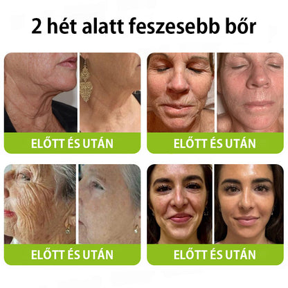 ✨ Vosxu™ Botox & Vita-A Retinol Shot ráncfelvarró szérum ✨ – 💉 Mikro-tűk | 💪 Botox-szerű peptidek | 🌿 Retinol | ⚡ Látható eredmények már 3 nap alatt