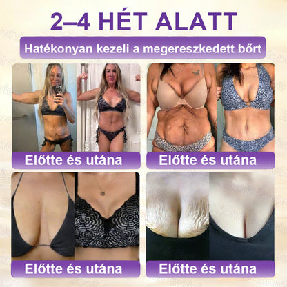 COLTURE® Biotin 10 az 1-ben bőrmegújító krém ✨ öregedés, pikkelysömör, akné, hegek, pigmentfoltok, szárazság, gyulladás és intim kellemetlenségek ellen 🌿 természetes bioaktív összetevőkkel 💧 a sima, feszes és fiatalos bőrért