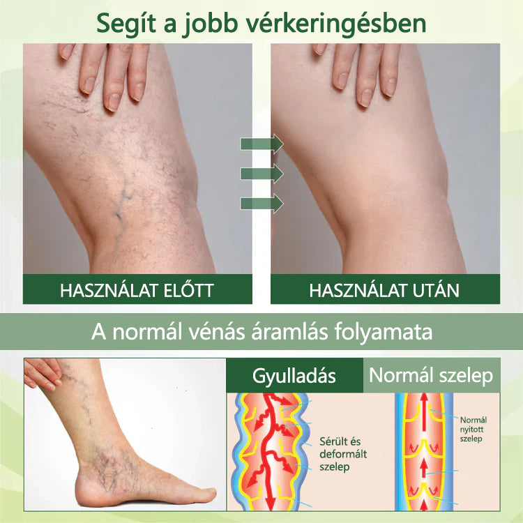 🌿 Mondjon búcsút a duzzadt, fájó lábaknak – Twinsun™ FluidEase Professional Lábkeringési Krém hozza a valódi megkönnyebbülést! ✨🦵