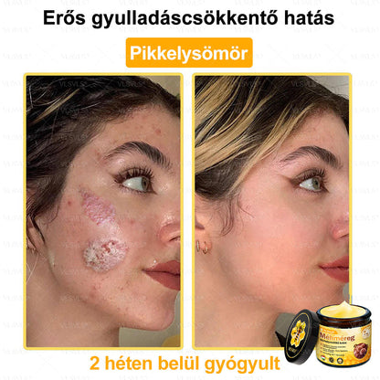 🔥🐝 VLSVLS® Méhméreg Bőrhelyreállító Krém | Teljeskörű Bőrregenerálás | Ekcéma, Pikkelysömör, Rosacea, Szemölcsök & Hegek Ellen | Gyors Hatás 5 Nap Alatt | 100% Természetes & Nem Invazív Megoldás 💯✨