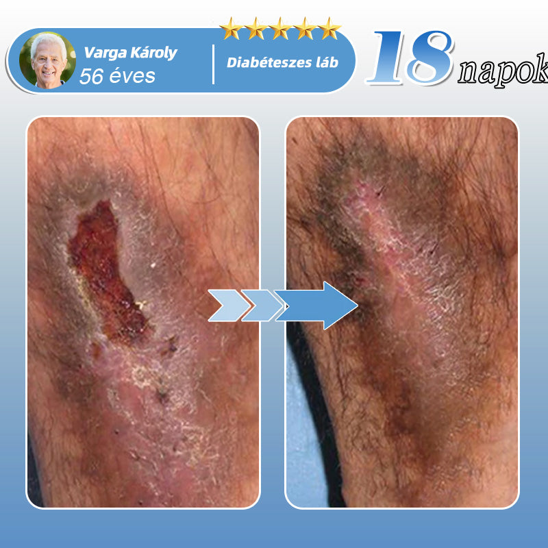 Healrize® MoveFree Vital tapasz ✨ – 🌿 Növényi & nyomelem alapú transzdermális tapasz 💪 Vérkeringés, ízületek, idegek & vércukorszint támogatására 🦵 Mindennapi kényelemért és mozgásszabadságért ✅