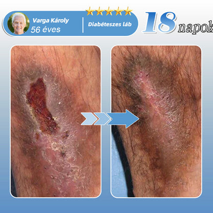 Healrize® MoveFree Vital tapasz ✨ – 🌿 Növényi & nyomelem alapú transzdermális tapasz 💪 Vérkeringés, ízületek, idegek & vércukorszint támogatására 🦵 Mindennapi kényelemért és mozgásszabadságért ✅
