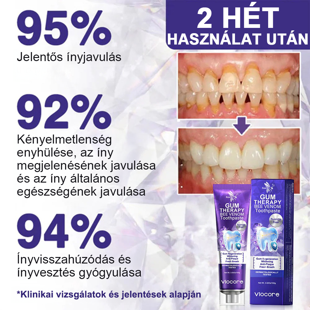🌟 Rolimey® VioCore Propolisz fogkrém 🦷 Fogfájás enyhítése 3 nap alatt · 7 napos ínyregeneráció · Parodontális betegségek megelőzése · Méhméreg és természetes ásványi anyagok tökéletes kombinációja 🌟
