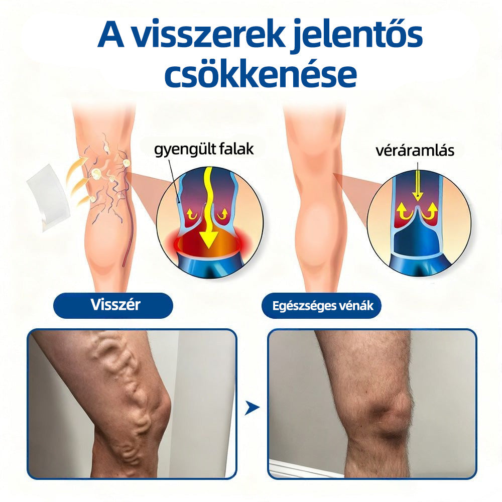 🇭🇺 𝐇𝐞𝐚𝐥𝐫𝐢𝐳𝐞® VeinTarget mikrotűs tapasz 🌿 | alpesi növényi vénás támogatás 🦵 | transzdermális mikrotű technológia ⚡ | krónikus vénás elégtelenségre | otthoni használat | gyors felszívódás | 96% klinikai siker 💪