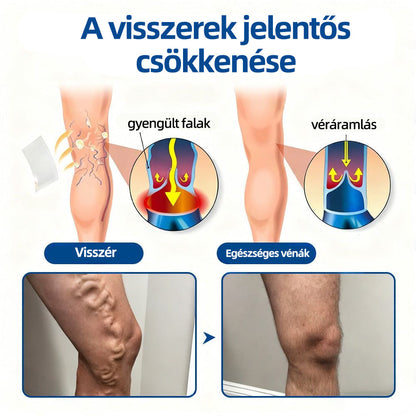 🇭🇺 𝐇𝐞𝐚𝐥𝐫𝐢𝐳𝐞® VeinTarget mikrotűs tapasz 🌿 | alpesi növényi vénás támogatás 🦵 | transzdermális mikrotű technológia ⚡ | krónikus vénás elégtelenségre | otthoni használat | gyors felszívódás | 96% klinikai siker 💪