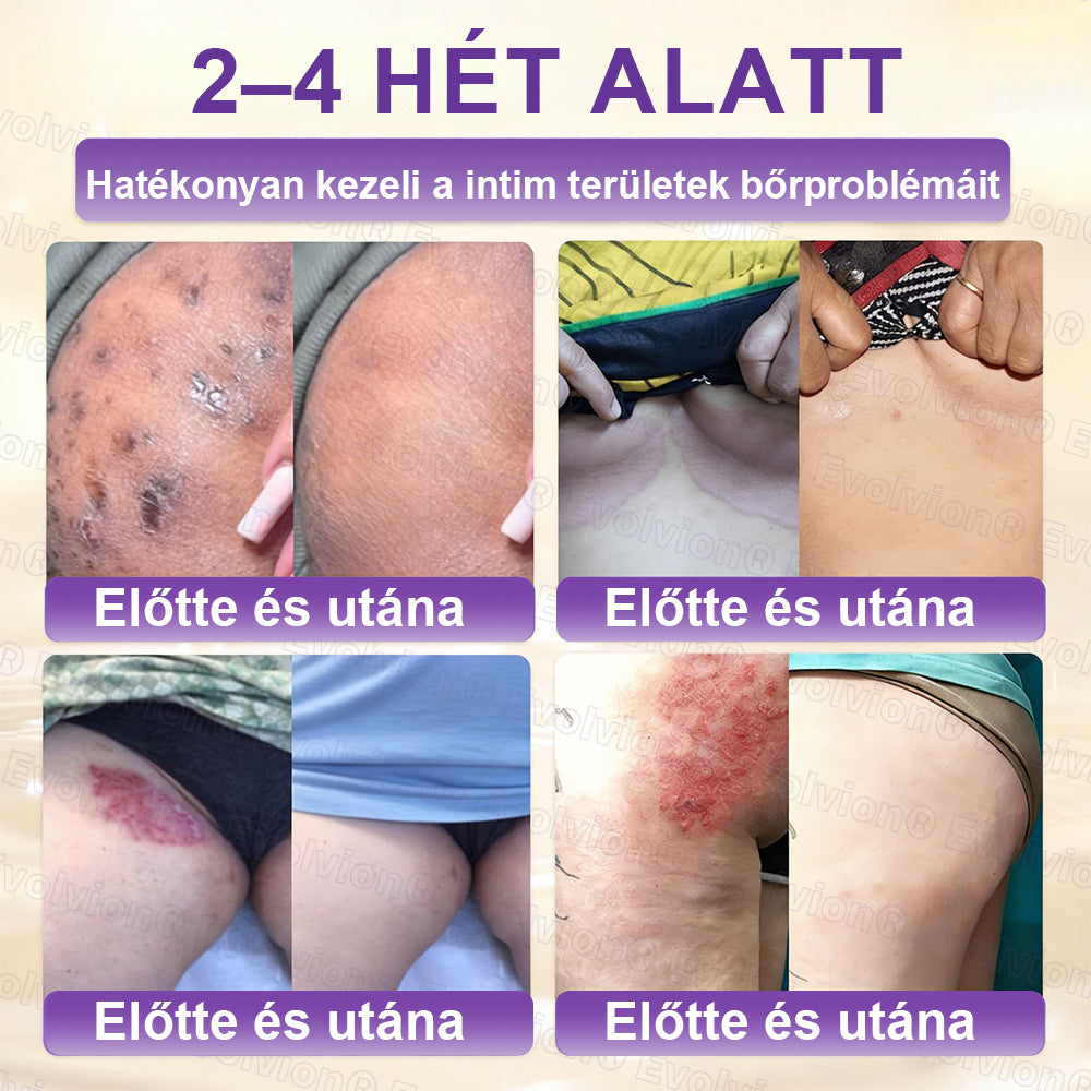 COLTURE® Biotin 10 az 1-ben bőrmegújító krém ✨ öregedés, pikkelysömör, akné, hegek, pigmentfoltok, szárazság, gyulladás és intim kellemetlenségek ellen 🌿 természetes bioaktív összetevőkkel 💧 a sima, feszes és fiatalos bőrért