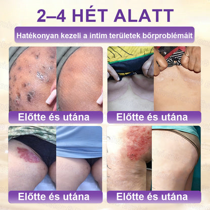 COLTURE® Biotin 10 az 1-ben bőrmegújító krém ✨ öregedés, pikkelysömör, akné, hegek, pigmentfoltok, szárazság, gyulladás és intim kellemetlenségek ellen 🌿 természetes bioaktív összetevőkkel 💧 a sima, feszes és fiatalos bőrért