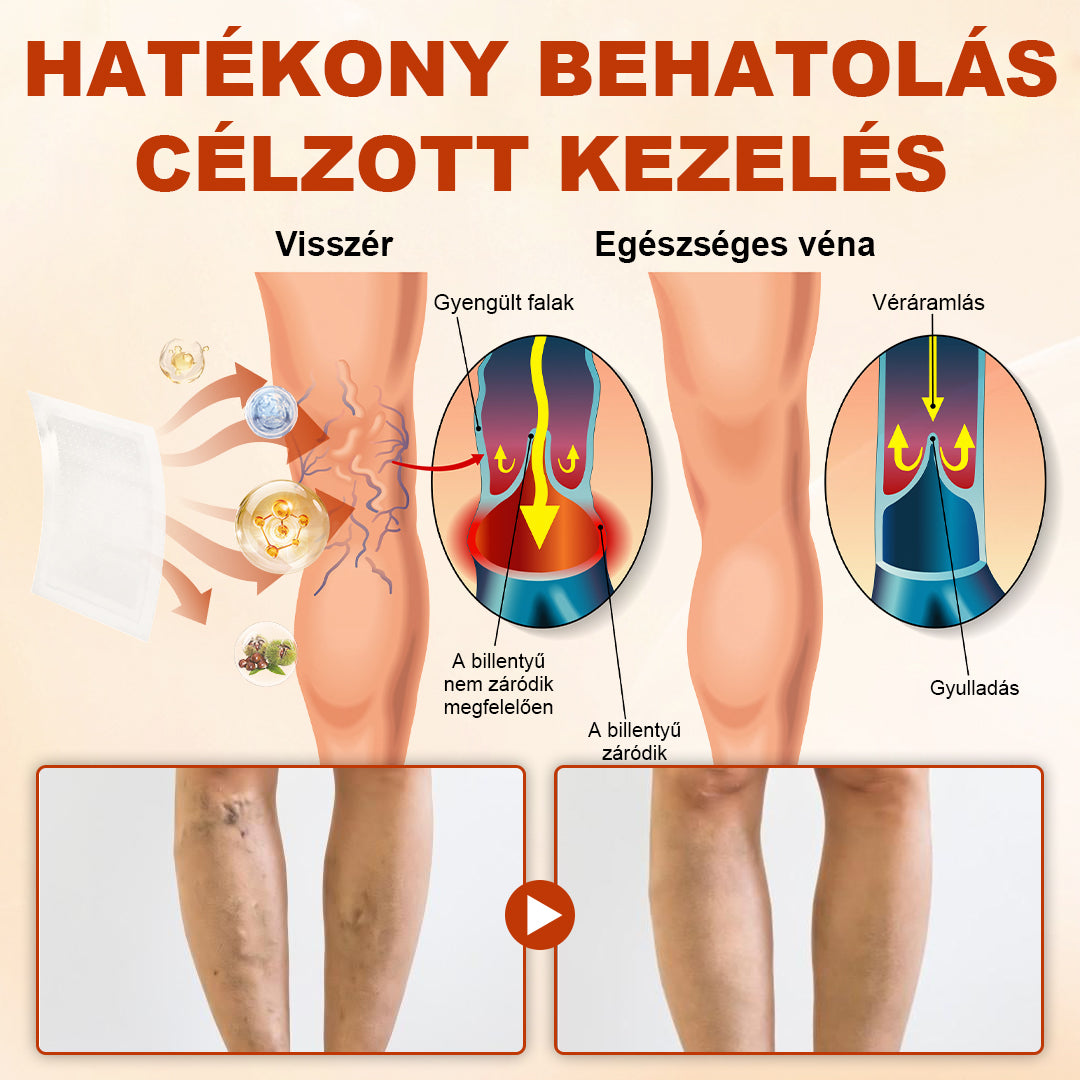 🦵 Healrize® VeinRepair Mikrotűs Tapsztekercs – 🔥 Célzott Ápolás Visszerekre, Duzzadt és Nehéz Lábakra⭐