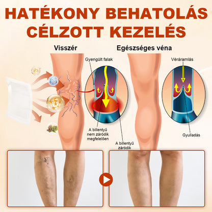 🦵 Healrize® VeinRepair Mikrotűs Tapsztekercs – 🔥 Célzott Ápolás Visszerekre, Duzzadt és Nehéz Lábakra⭐
