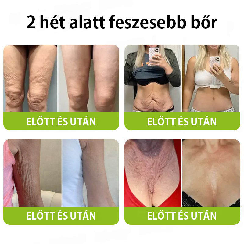 ✨ Vosxu™ Botox & Vita-A Retinol Shot ráncfelvarró szérum ✨ – 💉 Mikro-tűk | 💪 Botox-szerű peptidek | 🌿 Retinol | ⚡ Látható eredmények már 3 nap alatt