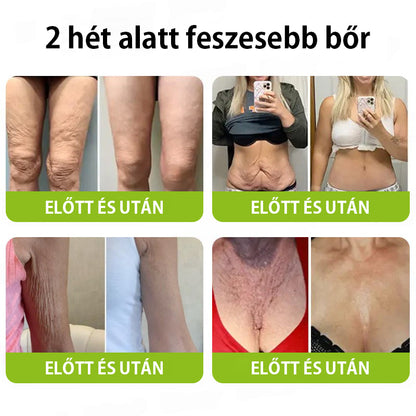 ✨ Vosxu™ Botox & Vita-A Retinol Shot ráncfelvarró szérum ✨ – 💉 Mikro-tűk | 💪 Botox-szerű peptidek | 🌿 Retinol | ⚡ Látható eredmények már 3 nap alatt