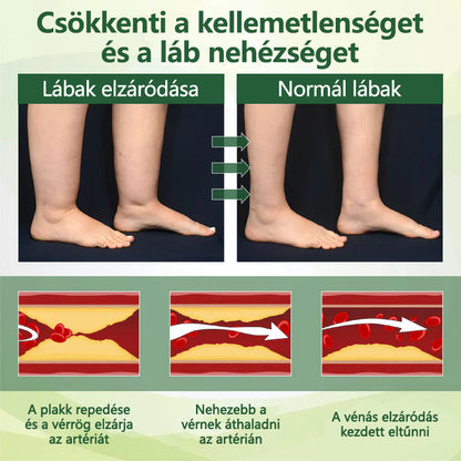 🌿 Mondjon búcsút a duzzadt, fájó lábaknak – Twinsun™ FluidEase Professional Lábkeringési Krém hozza a valódi megkönnyebbülést! ✨🦵
