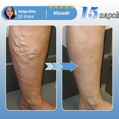 Healrize® MoveFree Vital tapasz ✨ – 🌿 Növényi & nyomelem alapú transzdermális tapasz 💪 Vérkeringés, ízületek, idegek & vércukorszint támogatására 🦵 Mindennapi kényelemért és mozgásszabadságért ✅