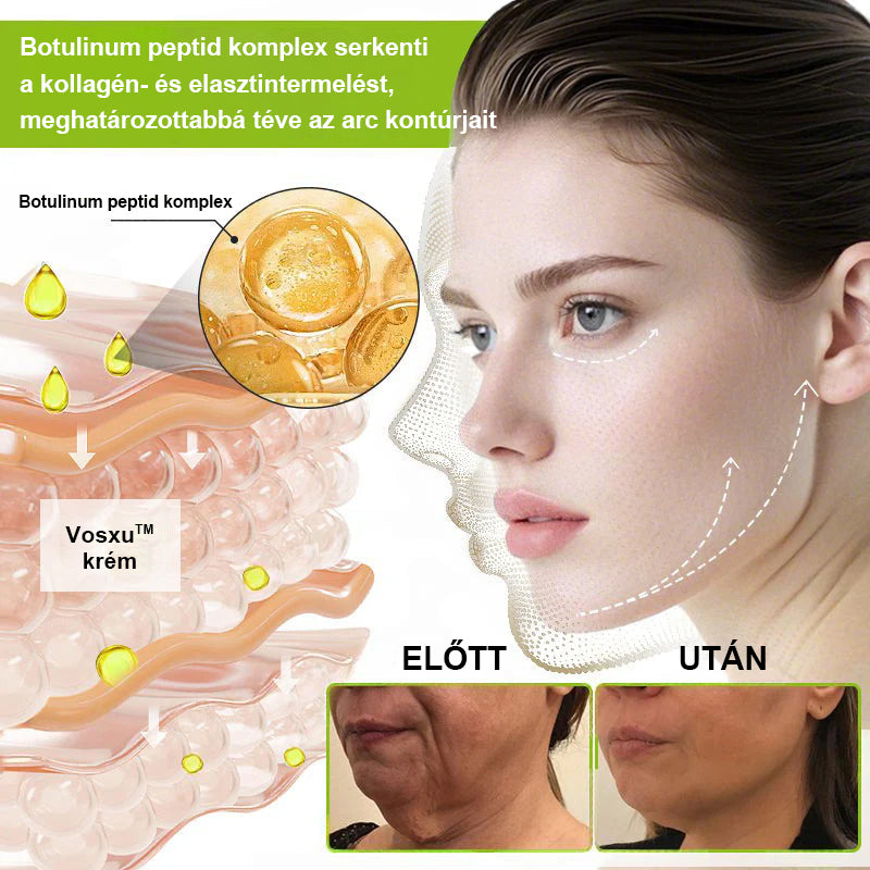 ✨ Vosxu™ Botox & Vita-A Retinol Shot ráncfelvarró szérum ✨ – 💉 Mikro-tűk | 💪 Botox-szerű peptidek | 🌿 Retinol | ⚡ Látható eredmények már 3 nap alatt