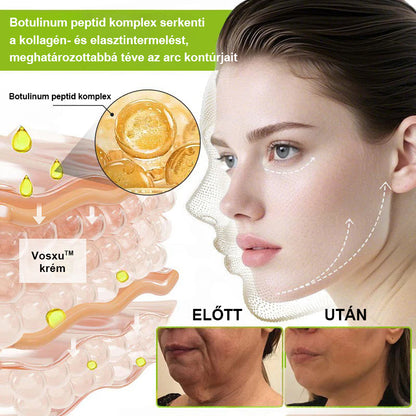 ✨ Vosxu™ Botox & Vita-A Retinol Shot ráncfelvarró szérum ✨ – 💉 Mikro-tűk | 💪 Botox-szerű peptidek | 🌿 Retinol | ⚡ Látható eredmények már 3 nap alatt