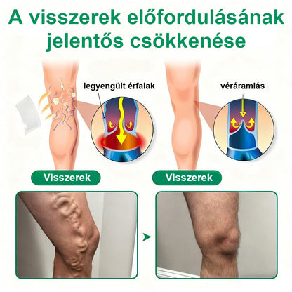 ✨ Twisma® VeinTarget – Fejlett mikro tapasz a visszerekre 🔥 96% klinikailag igazolt hatékonyság ⚡ Látható eredmények már 7–14 nap alatt 🌿 Kíméletes támogatás a könnyebb és felszabadult lábakért  🦵