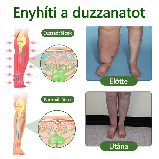 🌿 Mondjon búcsút a duzzadt, fájó lábaknak – Twinsun™ FluidEase Professional Lábkeringési Krém hozza a valódi megkönnyebbülést! ✨🦵