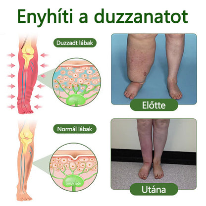 🌿 Mondjon búcsút a duzzadt, fájó lábaknak – Twinsun™ FluidEase Professional Lábkeringési Krém hozza a valódi megkönnyebbülést! ✨🦵