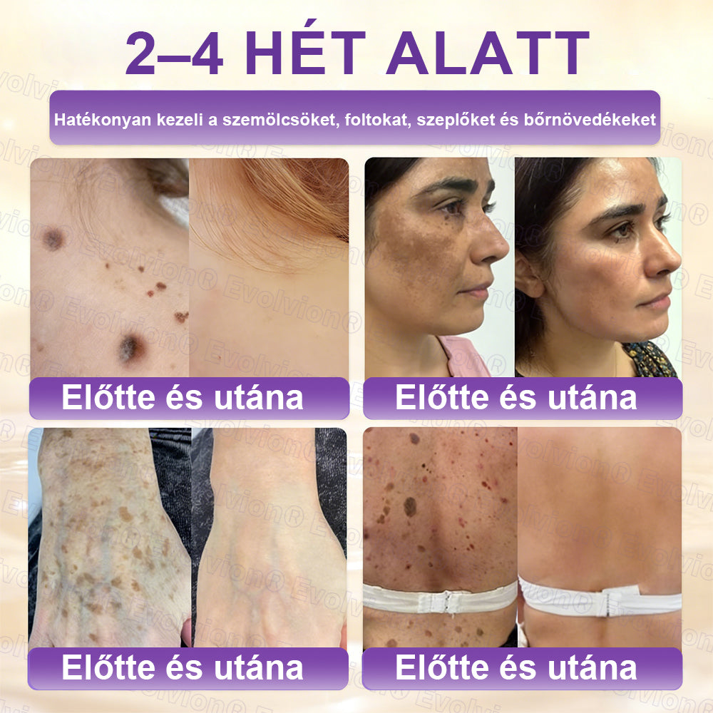 COLTURE® Biotin 10 az 1-ben bőrmegújító krém ✨ öregedés, pikkelysömör, akné, hegek, pigmentfoltok, szárazság, gyulladás és intim kellemetlenségek ellen 🌿 természetes bioaktív összetevőkkel 💧 a sima, feszes és fiatalos bőrért