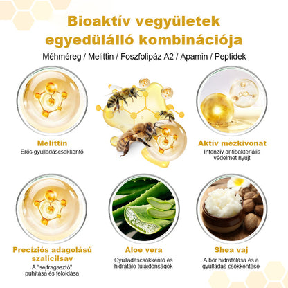 🐝 Auralithe® PsoriaSoothe – Szteroidmentes méhméreges krém viszkető, hámló és érzékeny bőrre 🍎