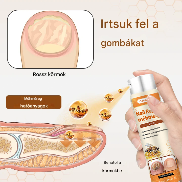 💥 2026 Korlátozott 70% KEDVEZMÉNY ️⏳ Ceoerty® NailRescue Kolirin méhméreg körömgomba spray 💥 Minden körömproblémát orvosolhatsz 2 héten belül🌿🌿