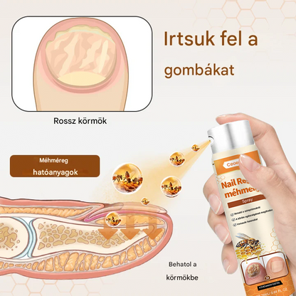 💥 2026 Korlátozott 70% KEDVEZMÉNY ️⏳ Ceoerty® NailRescue Kolirin méhméreg körömgomba spray 💥 Minden körömproblémát orvosolhatsz 2 héten belül🌿🌿