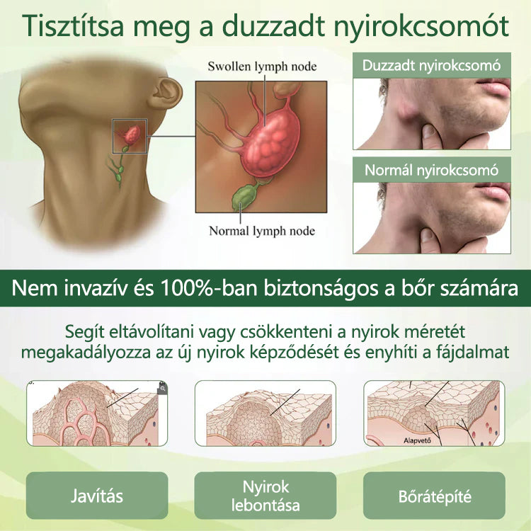 🌿 Mondjon búcsút a duzzadt, fájó lábaknak – Twinsun™ FluidEase Professional Lábkeringési Krém hozza a valódi megkönnyebbülést! ✨🦵