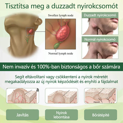 🌿 Mondjon búcsút a duzzadt, fájó lábaknak – Twinsun™ FluidEase Professional Lábkeringési Krém hozza a valódi megkönnyebbülést! ✨🦵