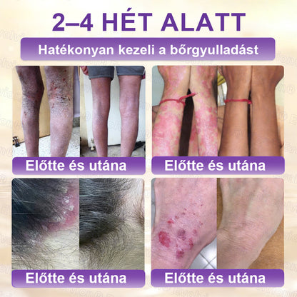 COLTURE® Biotin 10 az 1-ben bőrmegújító krém ✨ öregedés, pikkelysömör, akné, hegek, pigmentfoltok, szárazság, gyulladás és intim kellemetlenségek ellen 🌿 természetes bioaktív összetevőkkel 💧 a sima, feszes és fiatalos bőrért